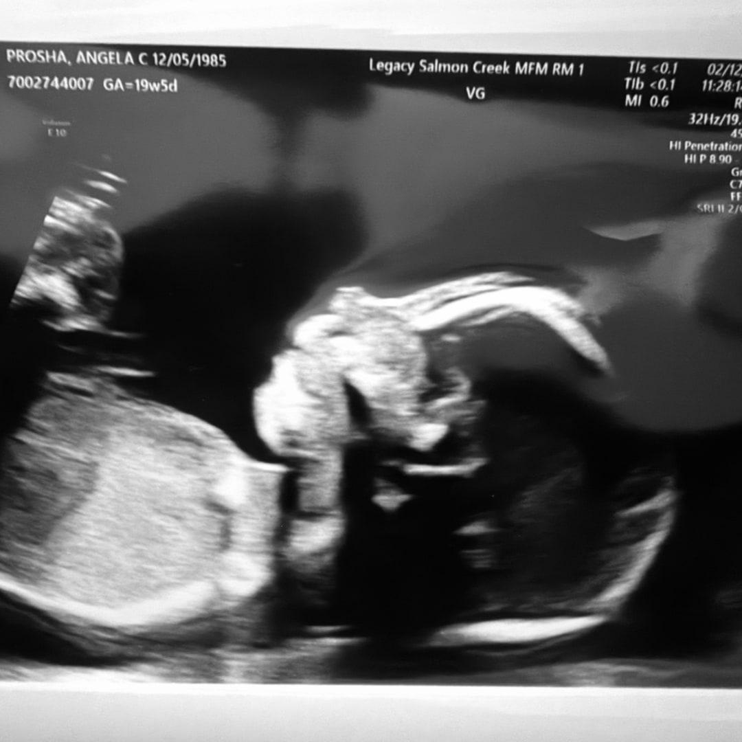 Photo shared by Angela for their Babylist baby registry.