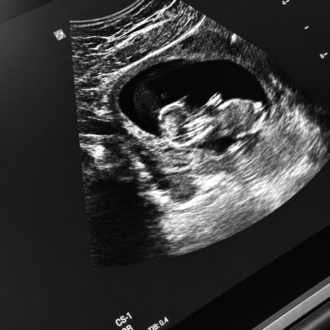 Photo shared by Cora for their Babylist baby registry.