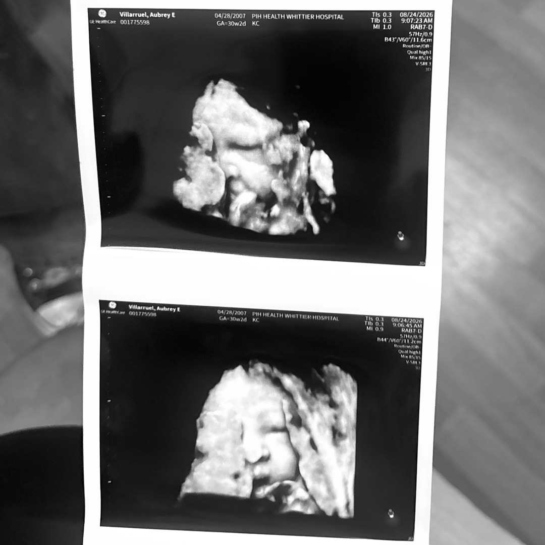 Photo shared by Aubrey for their Babylist baby registry.