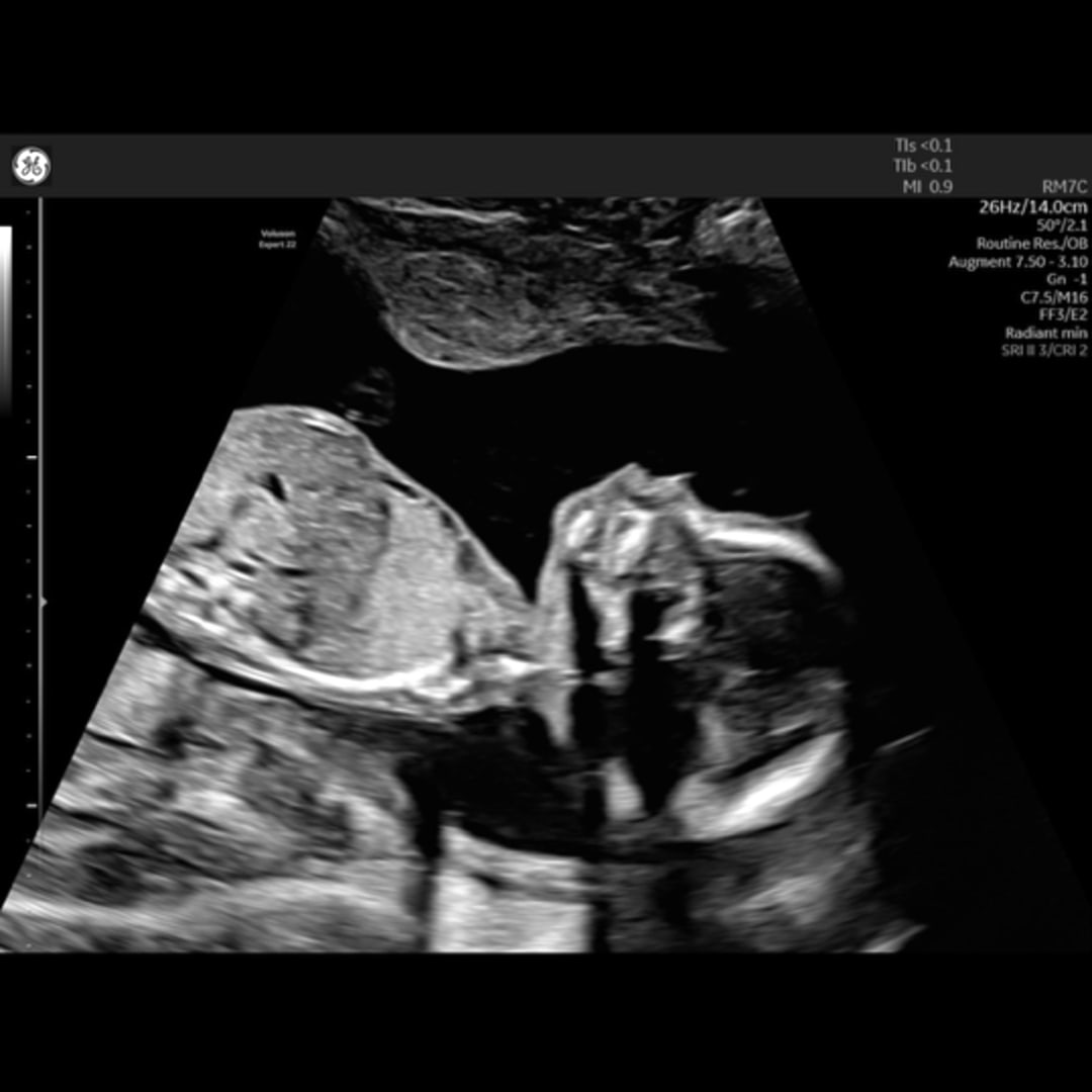 Photo shared by Angelique for their Babylist baby registry.