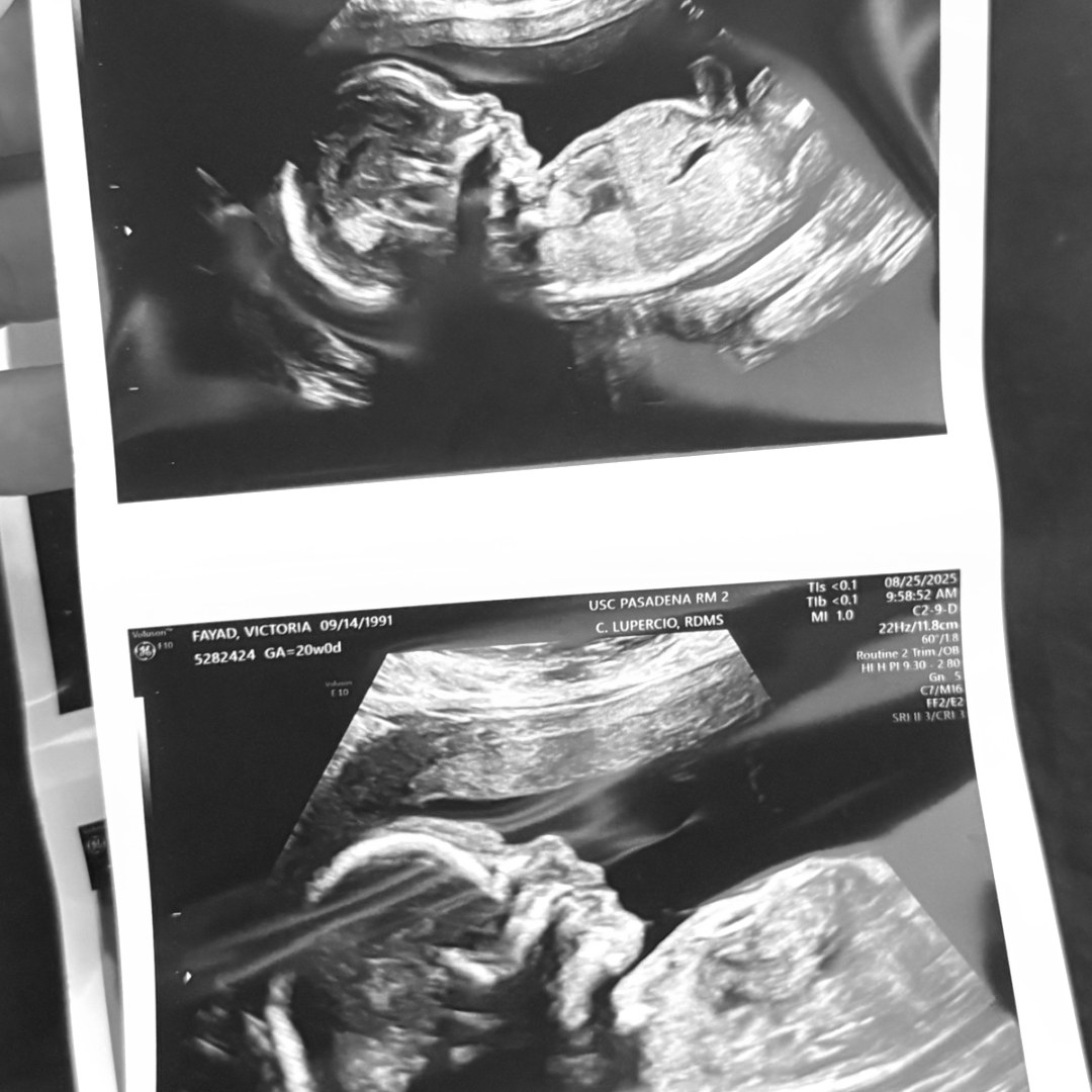 Photo shared by Victoria for their Babylist baby registry.