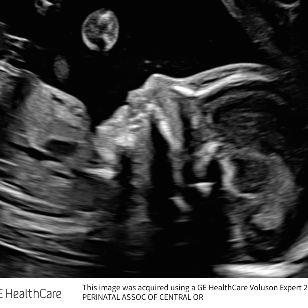 Photo shared by Rebekah for their Babylist baby registry.