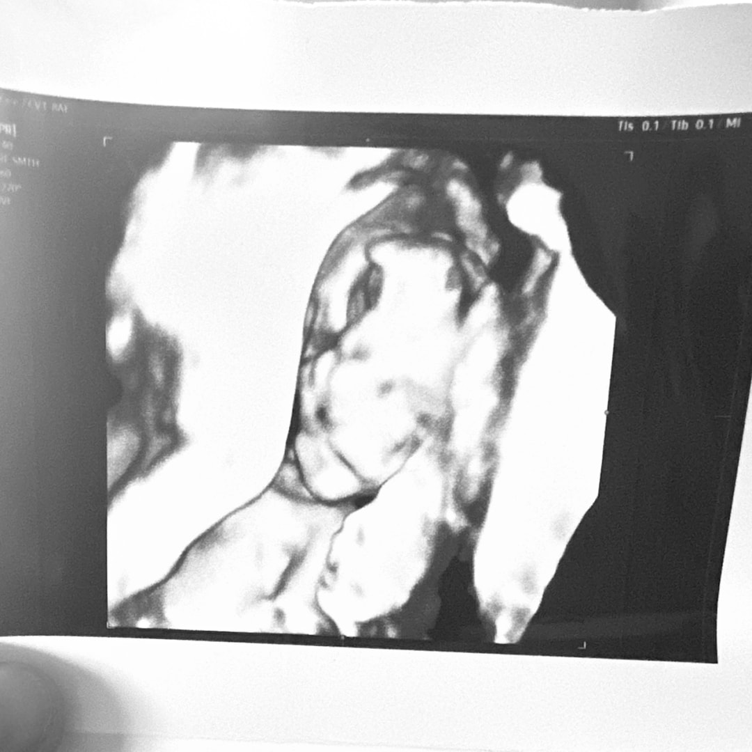 Photo shared by Anna for their Babylist baby registry.