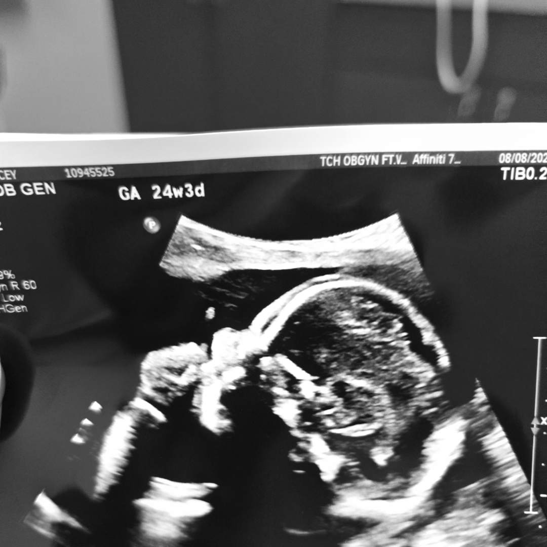 Photo shared by Lacey for their Babylist baby registry.