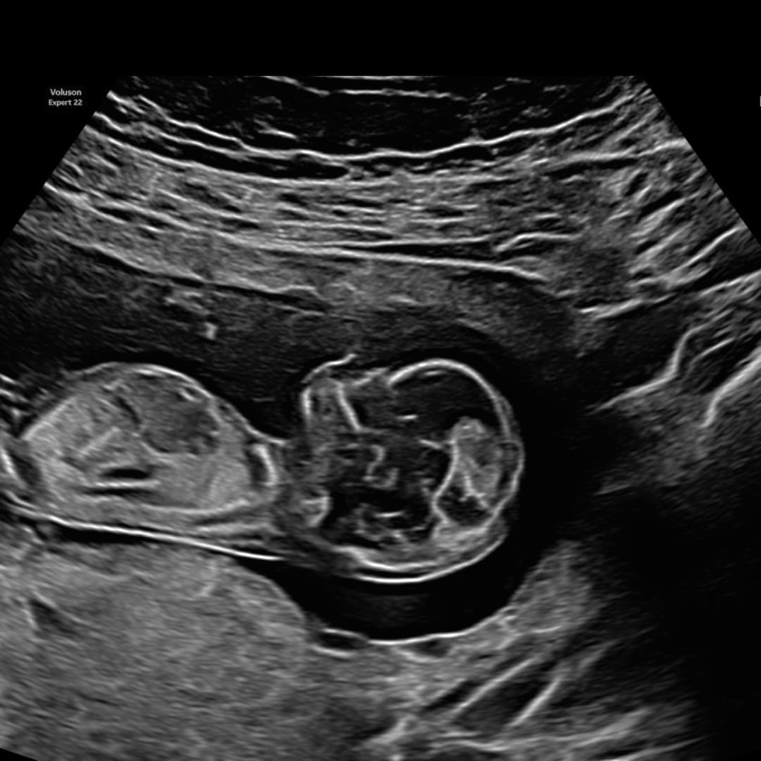 Photo shared by Luithsy for their Babylist baby registry.