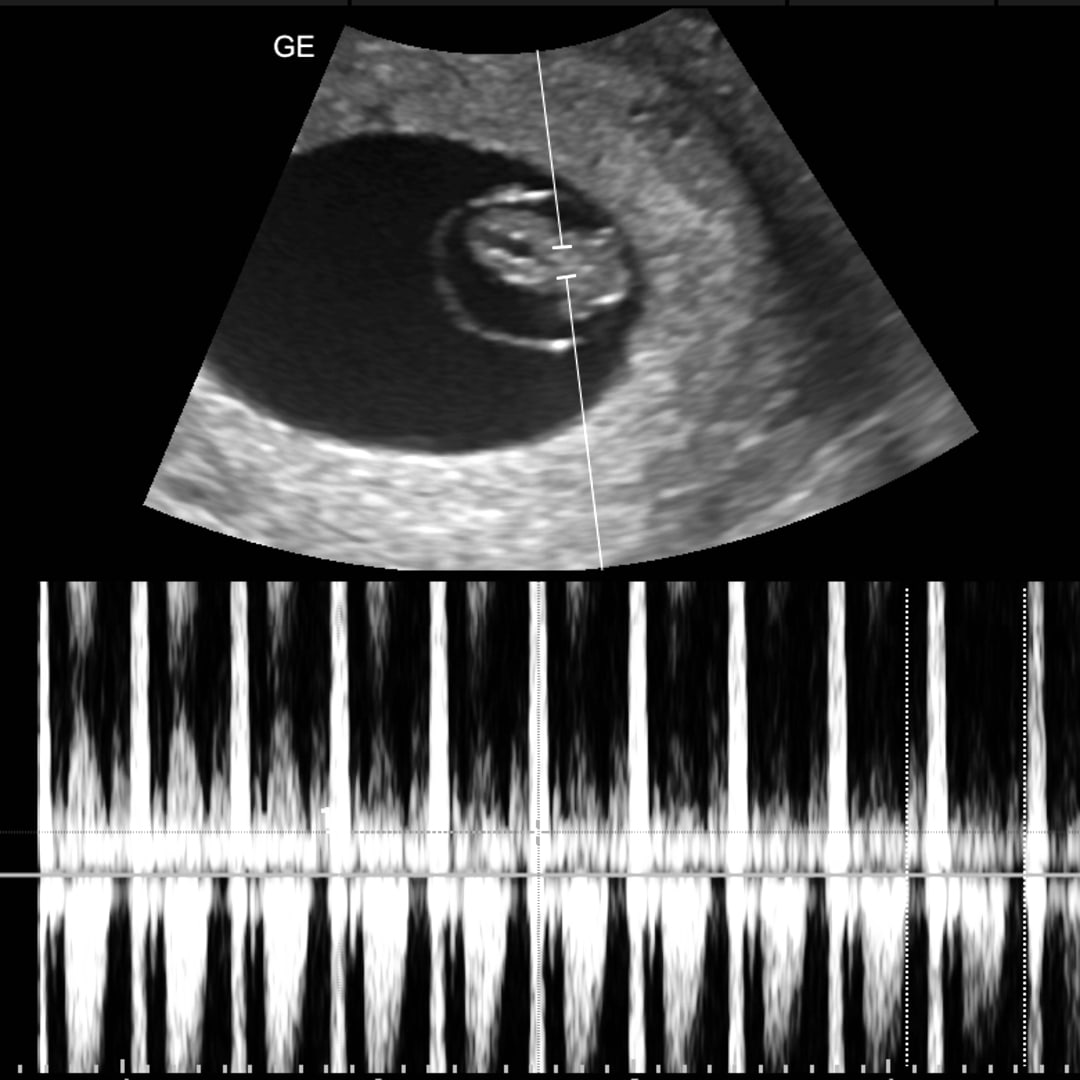 Photo shared by Ely for their Babylist baby registry.