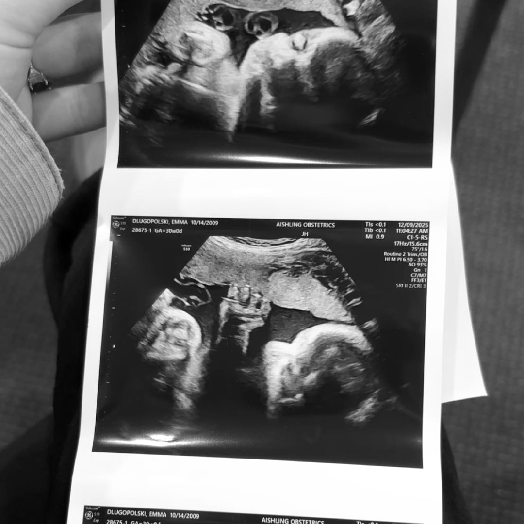 Photo shared by Emma for their Babylist baby registry.