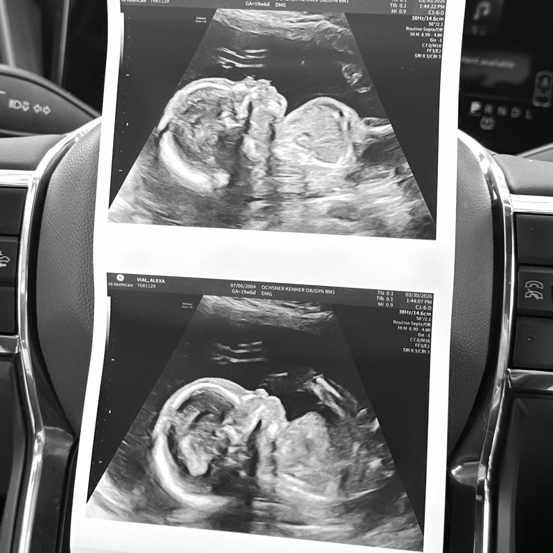 Photo shared by Alexa for their Babylist baby registry.