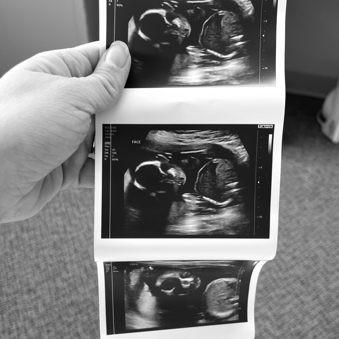 Photo shared by Makayla for their Babylist baby registry.