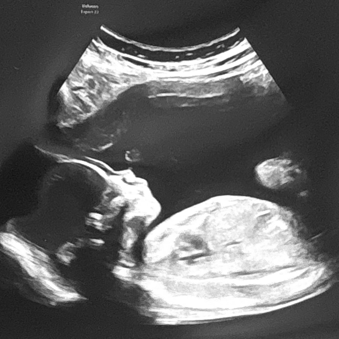 Photo shared by Loni for their Babylist baby registry.