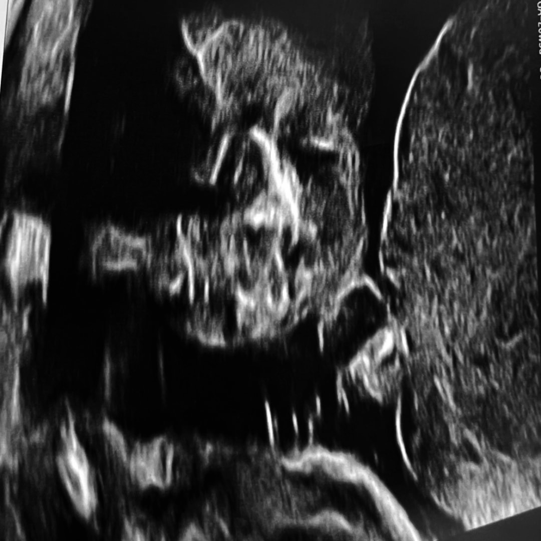 Photo shared by Maria for their Babylist baby registry.