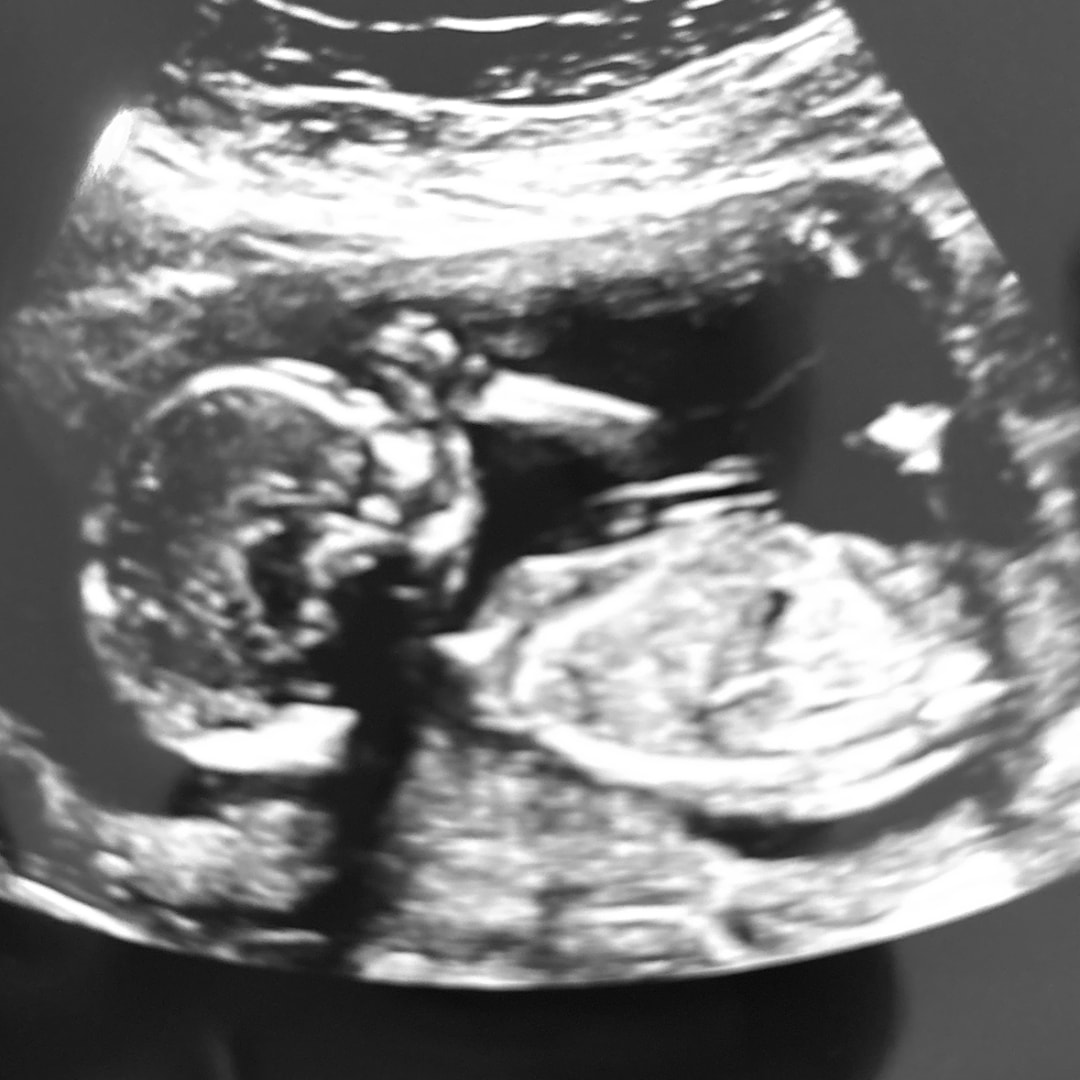 Photo shared by Karla for their Babylist baby registry.