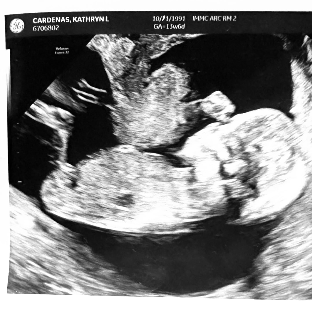 Photo shared by Katie for their Babylist baby registry.