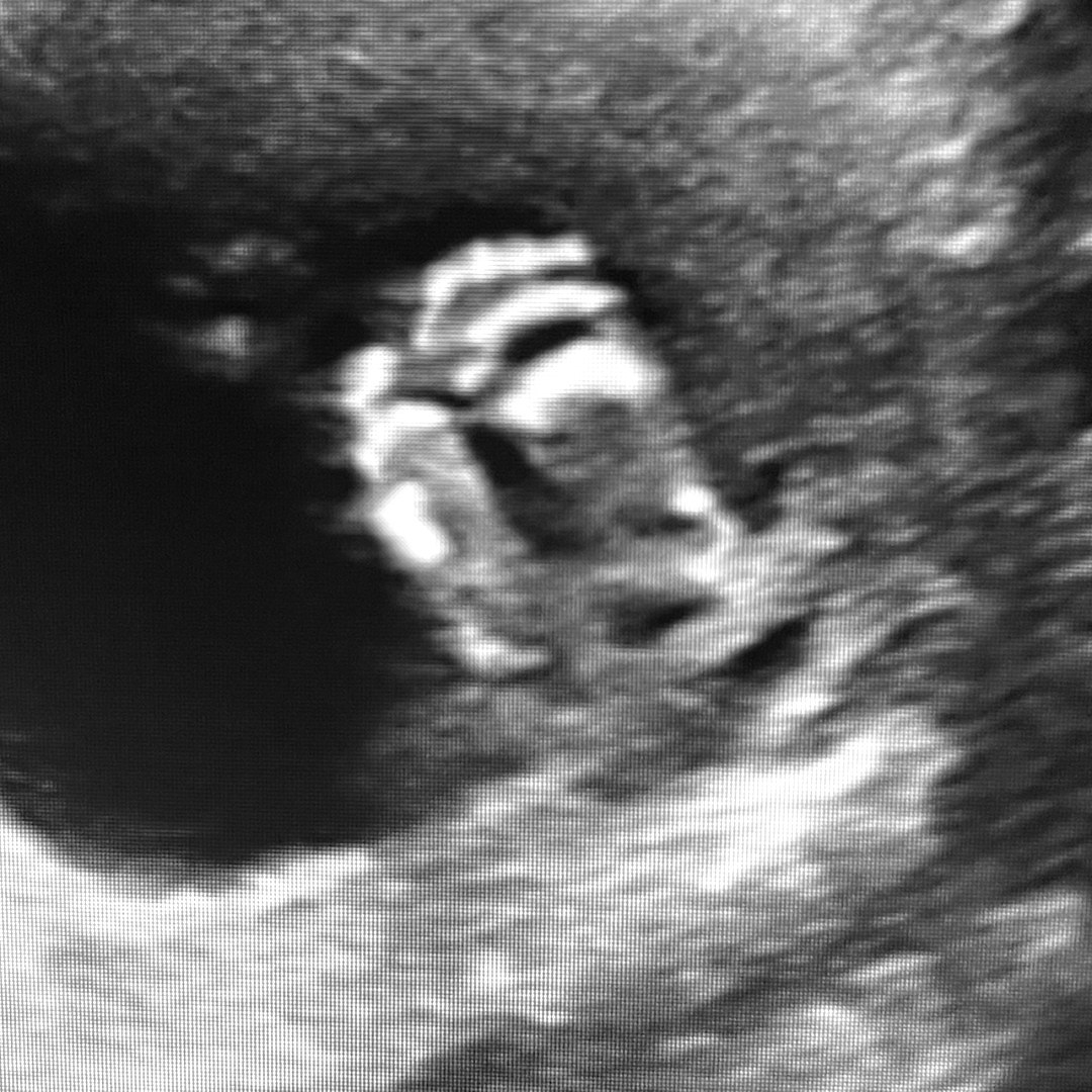 Photo shared by Erin for their Babylist baby registry.