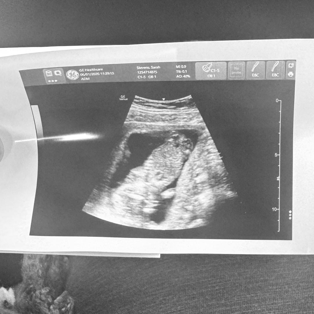 Photo shared by Sarah for their Babylist baby registry.