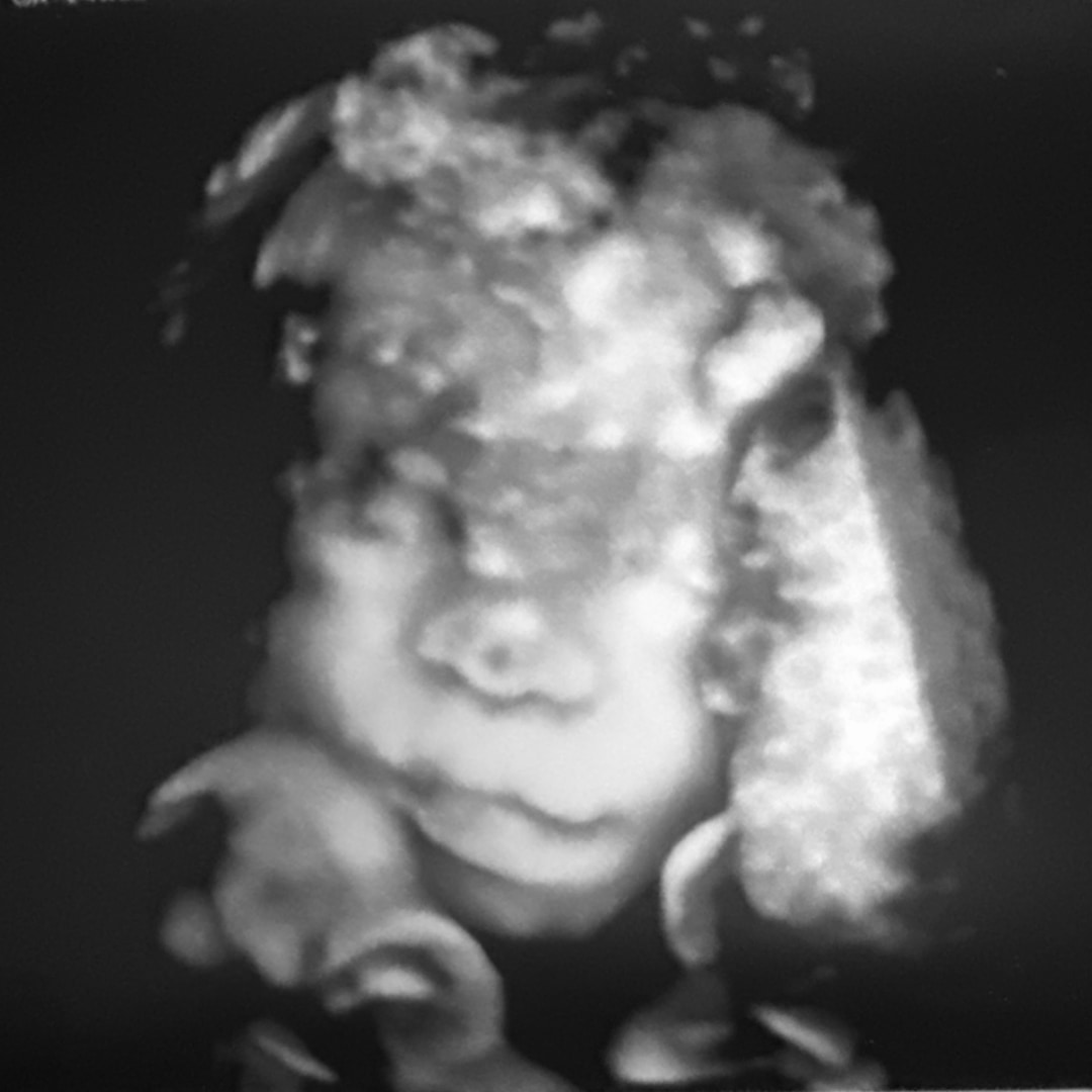 Photo shared by Bianca for their Babylist baby registry.