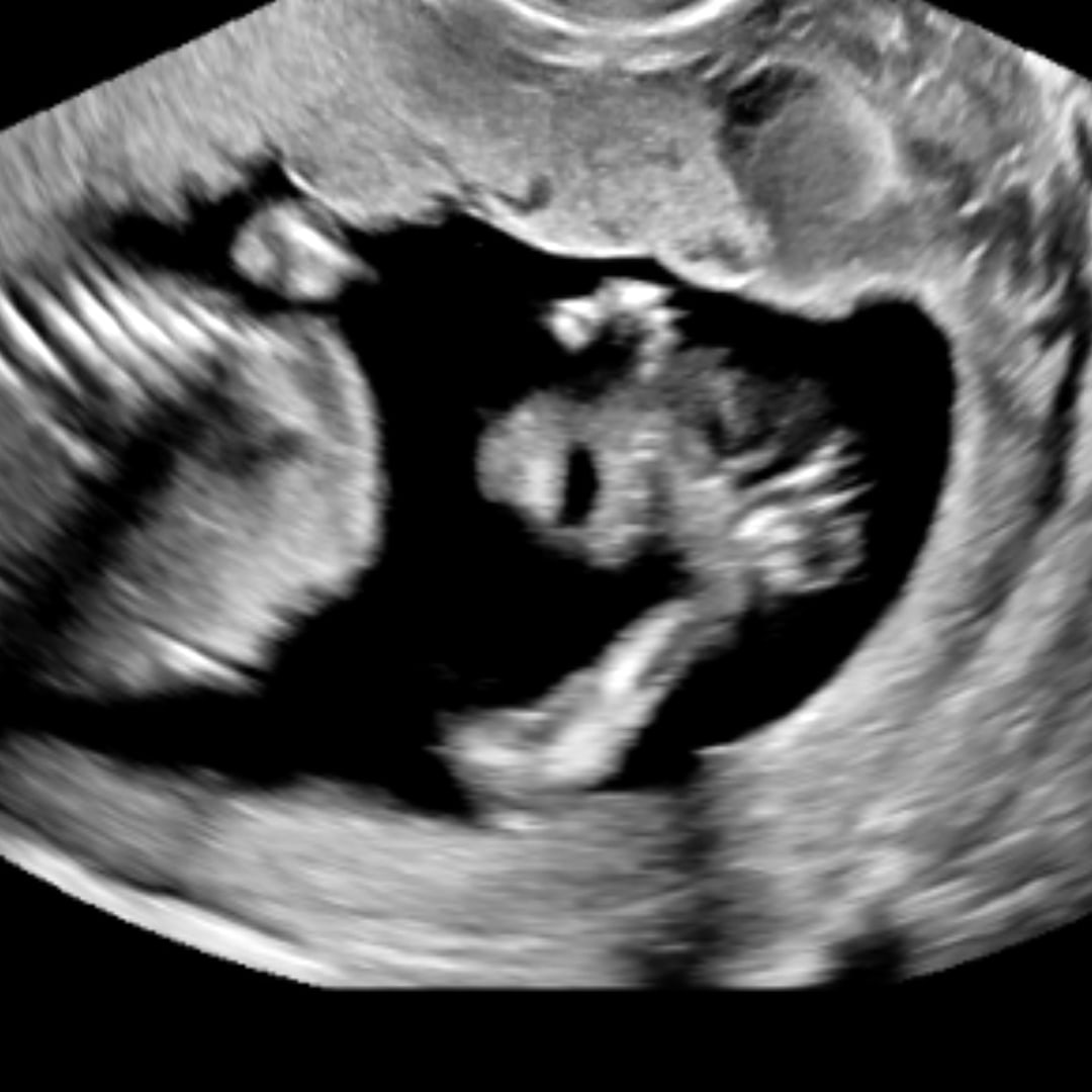 Photo shared by Baylee for their Babylist baby registry.