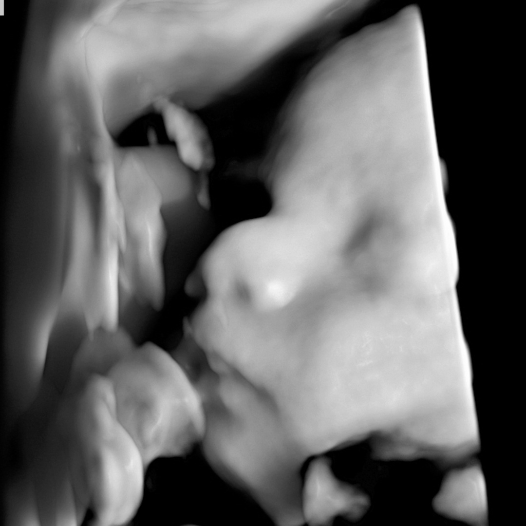 Photo shared by Caitlyn for their Babylist baby registry.