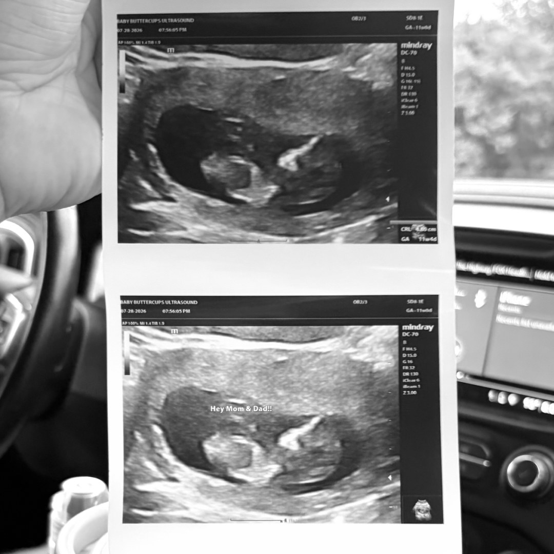 Photo shared by Shelby for their Babylist baby registry.