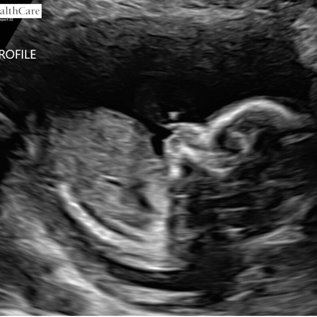 Photo shared by Abigail for their Babylist baby registry.
