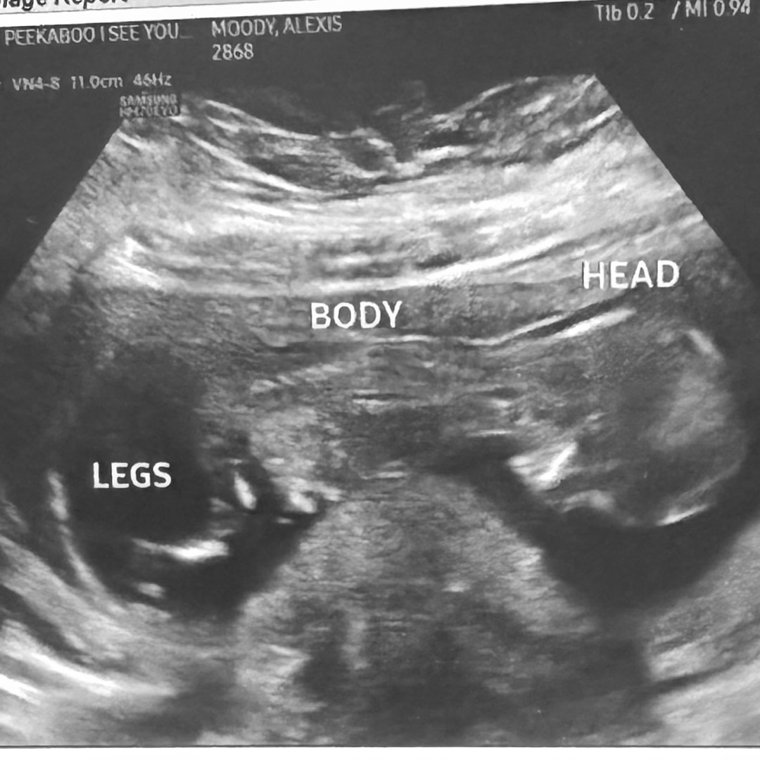 Photo shared by Lexi for their Babylist baby registry.