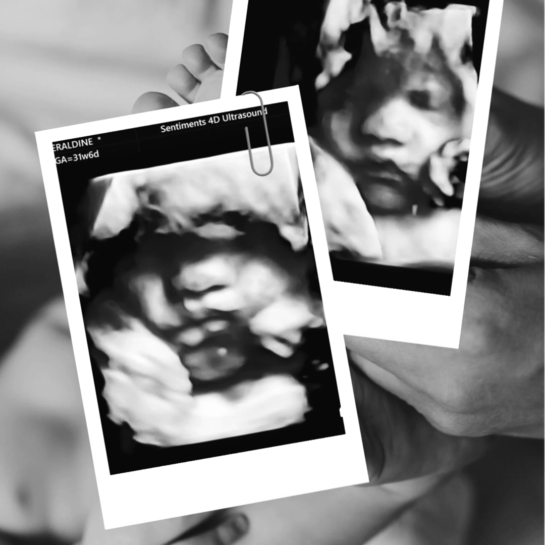 Photo shared by Geraldine for their Babylist baby registry.