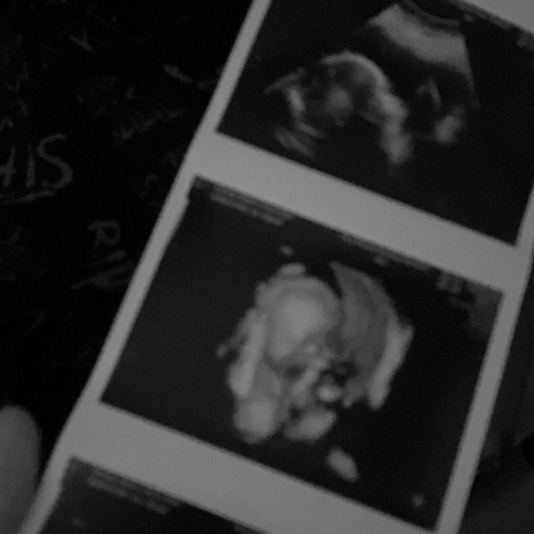 Photo shared by Alexis for their Babylist baby registry.