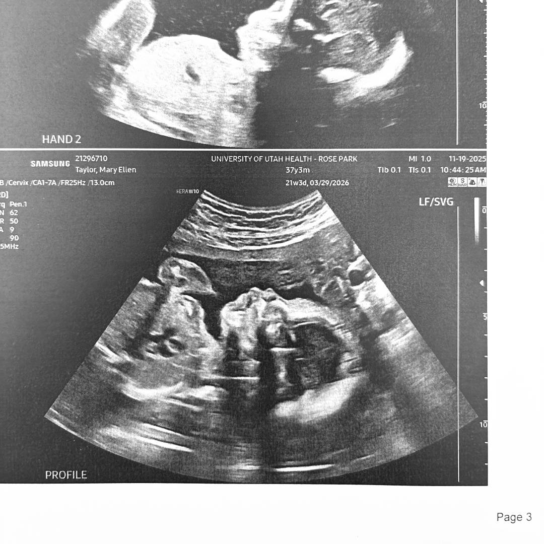 Photo shared by MaryEllen for their Babylist baby registry.