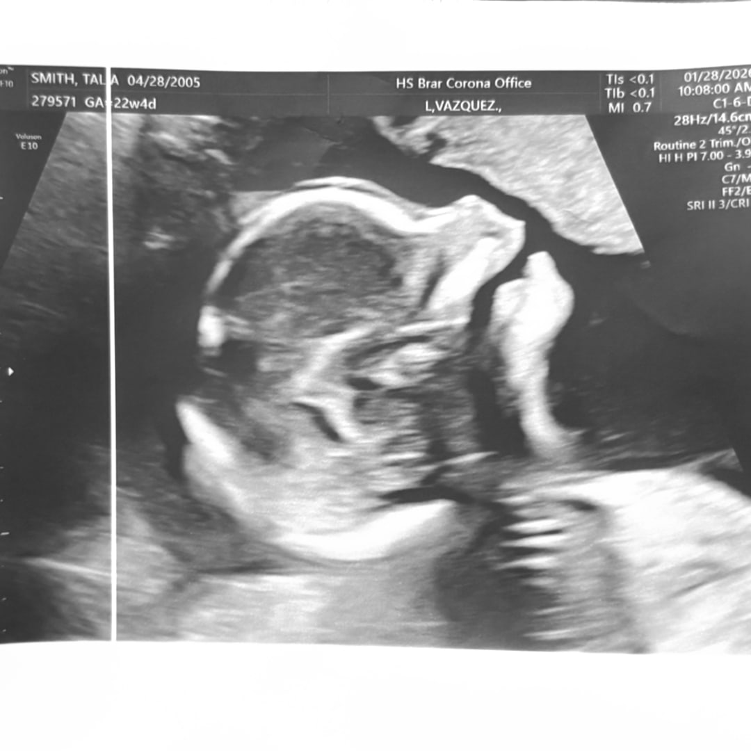 Photo shared by Talia for their Babylist baby registry.