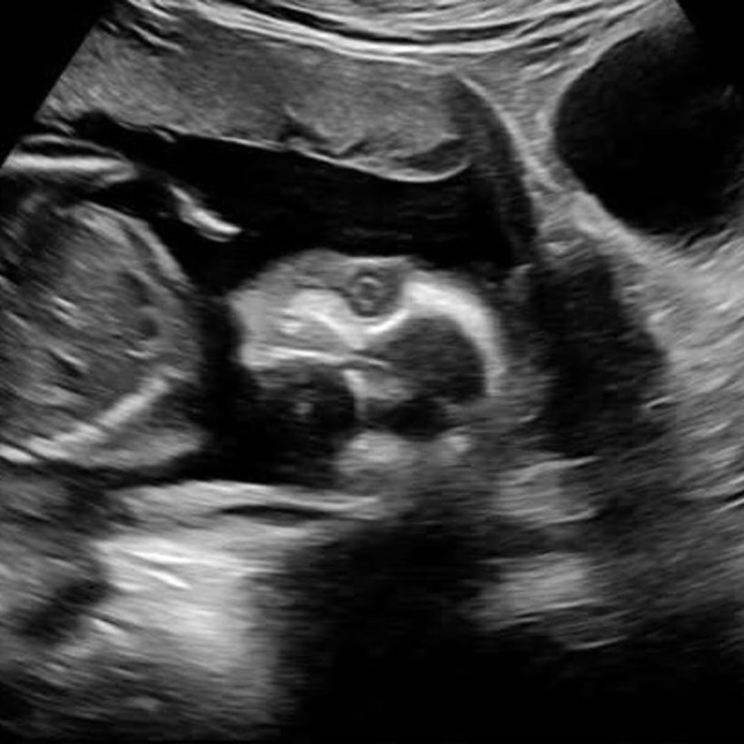 Photo shared by Kayle for their Babylist baby registry.