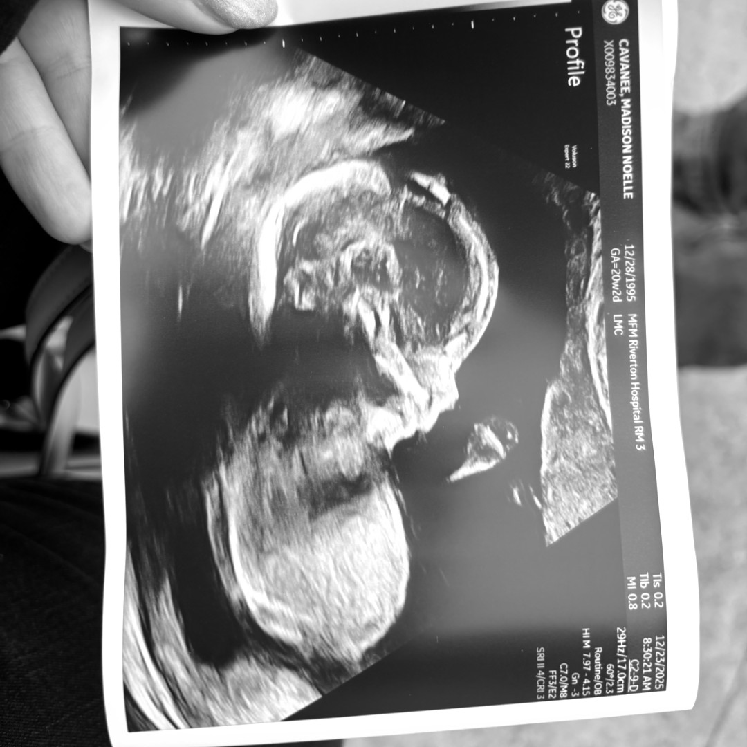 Photo shared by Madison for their Babylist baby registry.