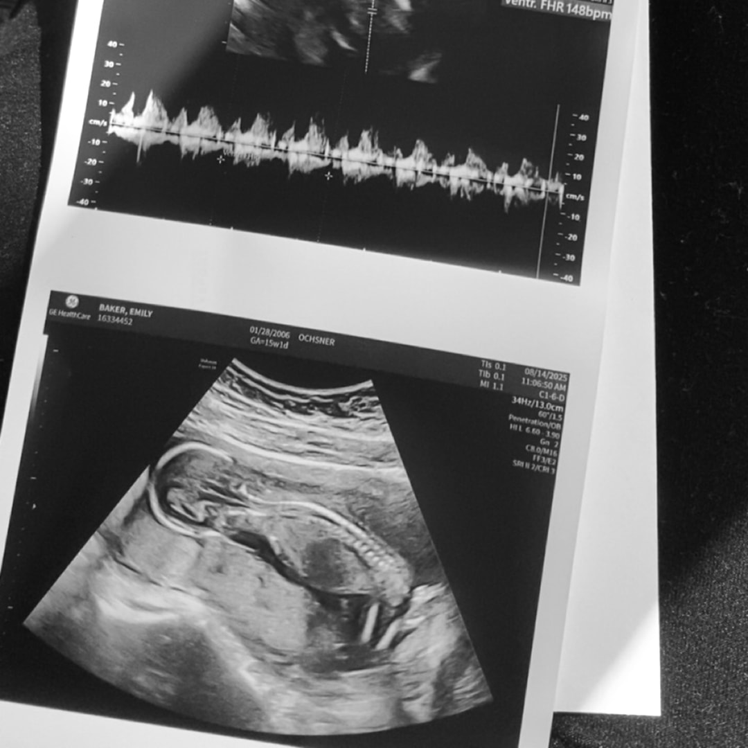 Photo shared by Emily for their Babylist baby registry.