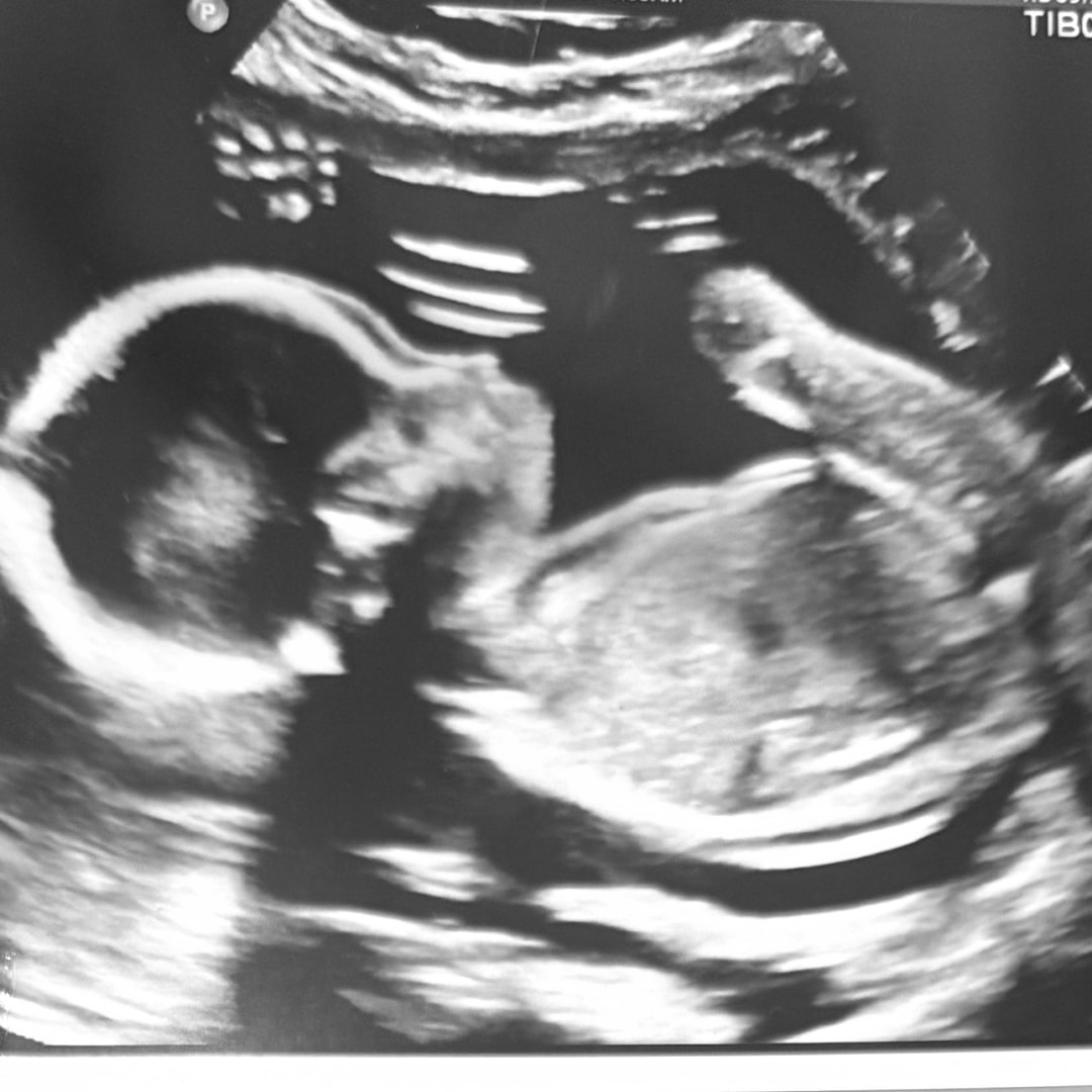 Photo shared by Carissa for their Babylist baby registry.