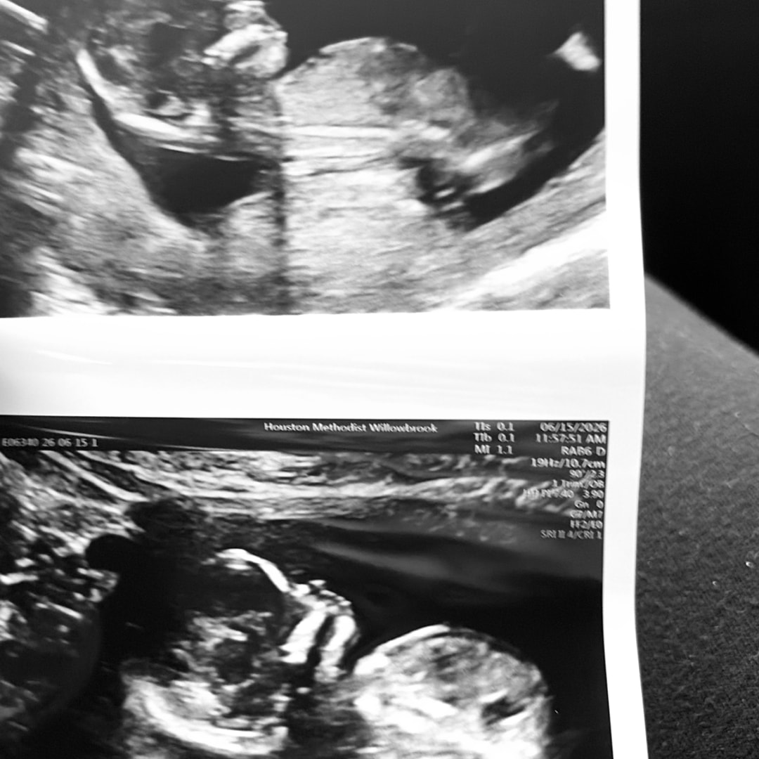 Photo shared by Adalia for their Babylist baby registry.