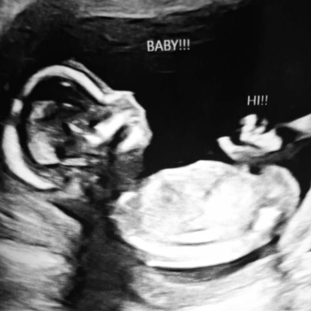 Photo shared by Crystal for their Babylist baby registry.