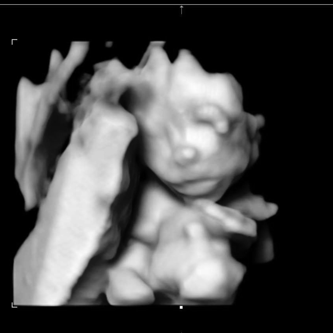 Photo shared by Hannah-Ireland for their Babylist baby registry.