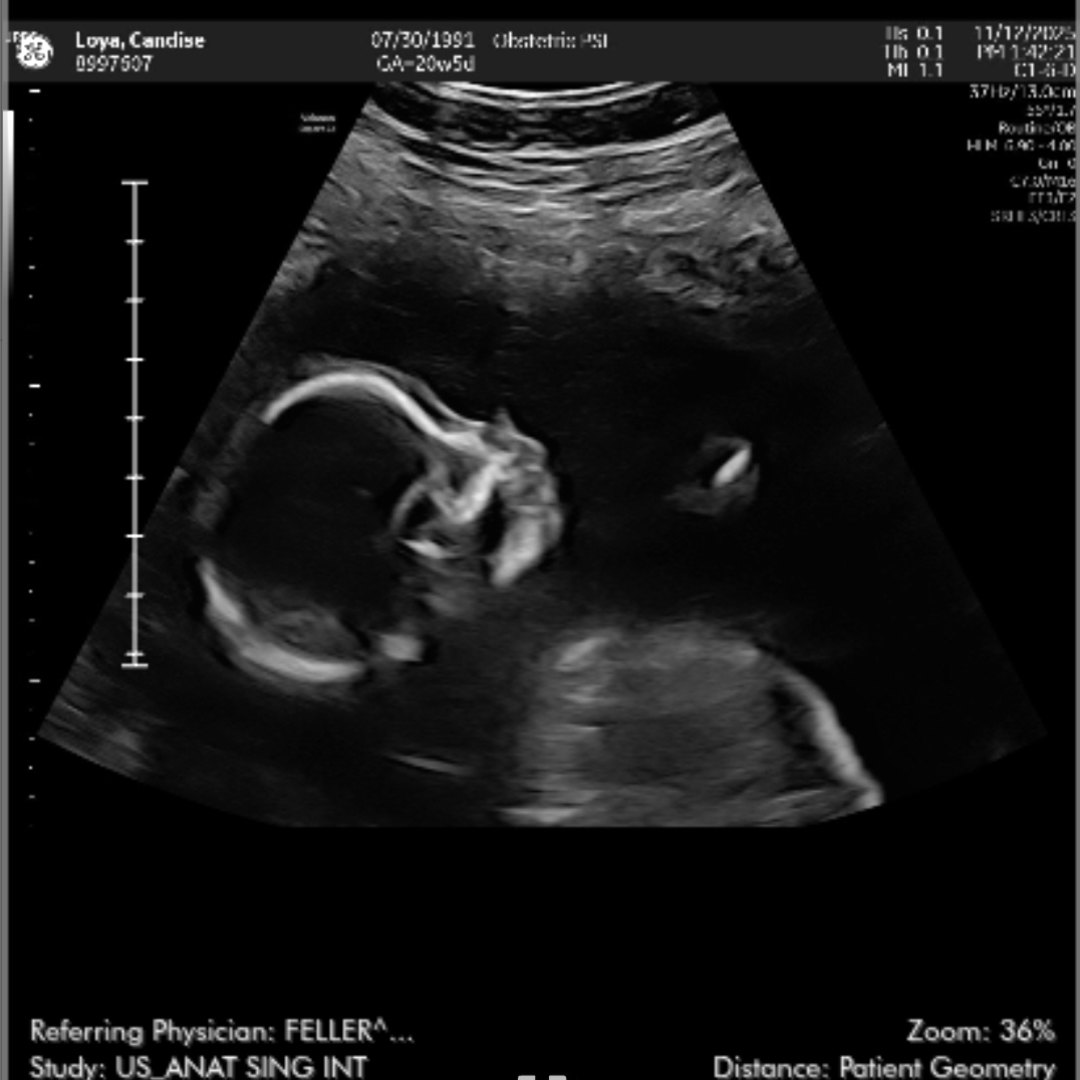 Photo shared by David & Candise for their Babylist baby registry.