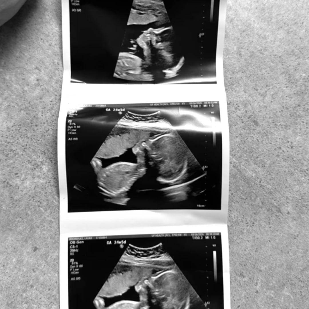 Photo shared by Laura for their Babylist baby registry.