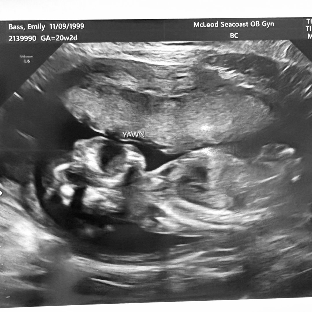 Photo shared by Emily for their Babylist baby registry.