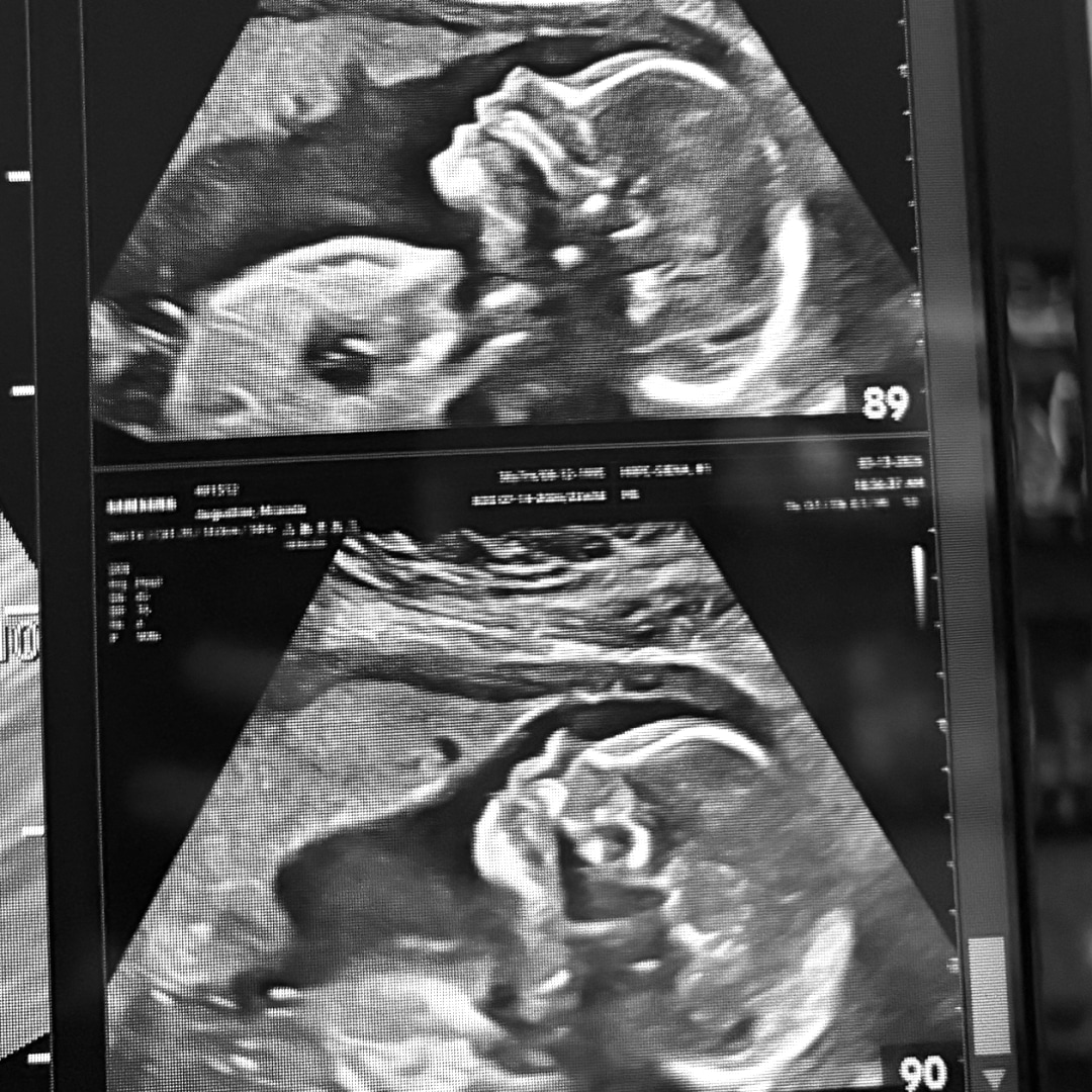 Photo shared by Miranda for their Babylist baby registry.