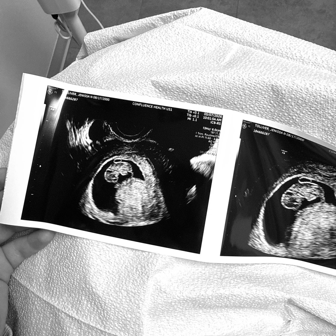 Photo shared by Jenissa for their Babylist baby registry.