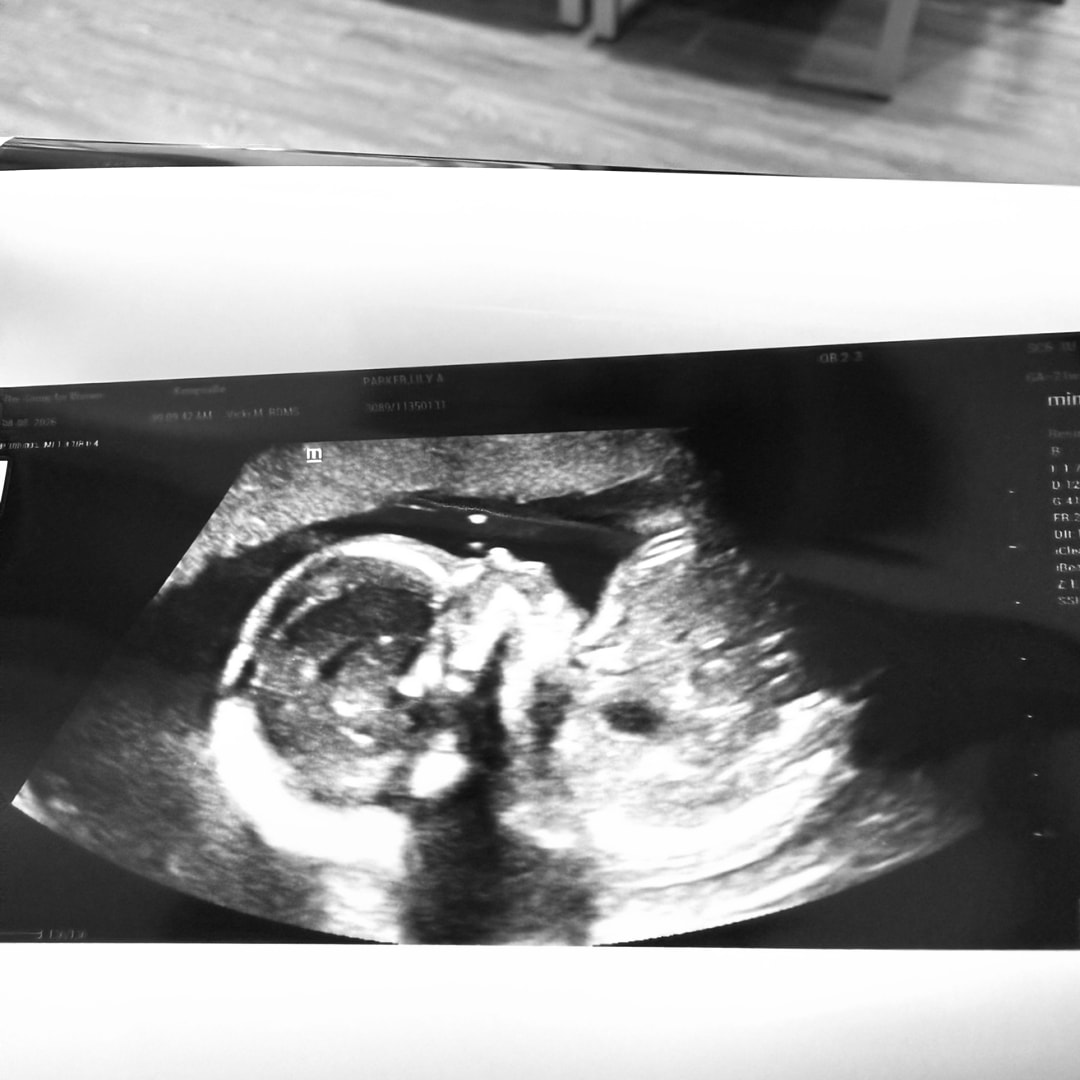 Photo shared by Lily for their Babylist baby registry.