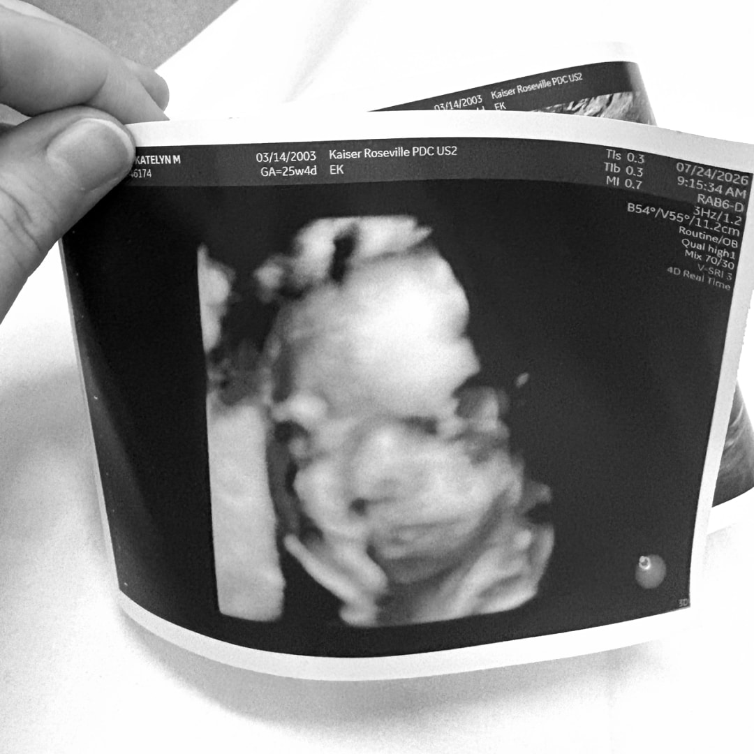 Photo shared by Katie for their Babylist baby registry.