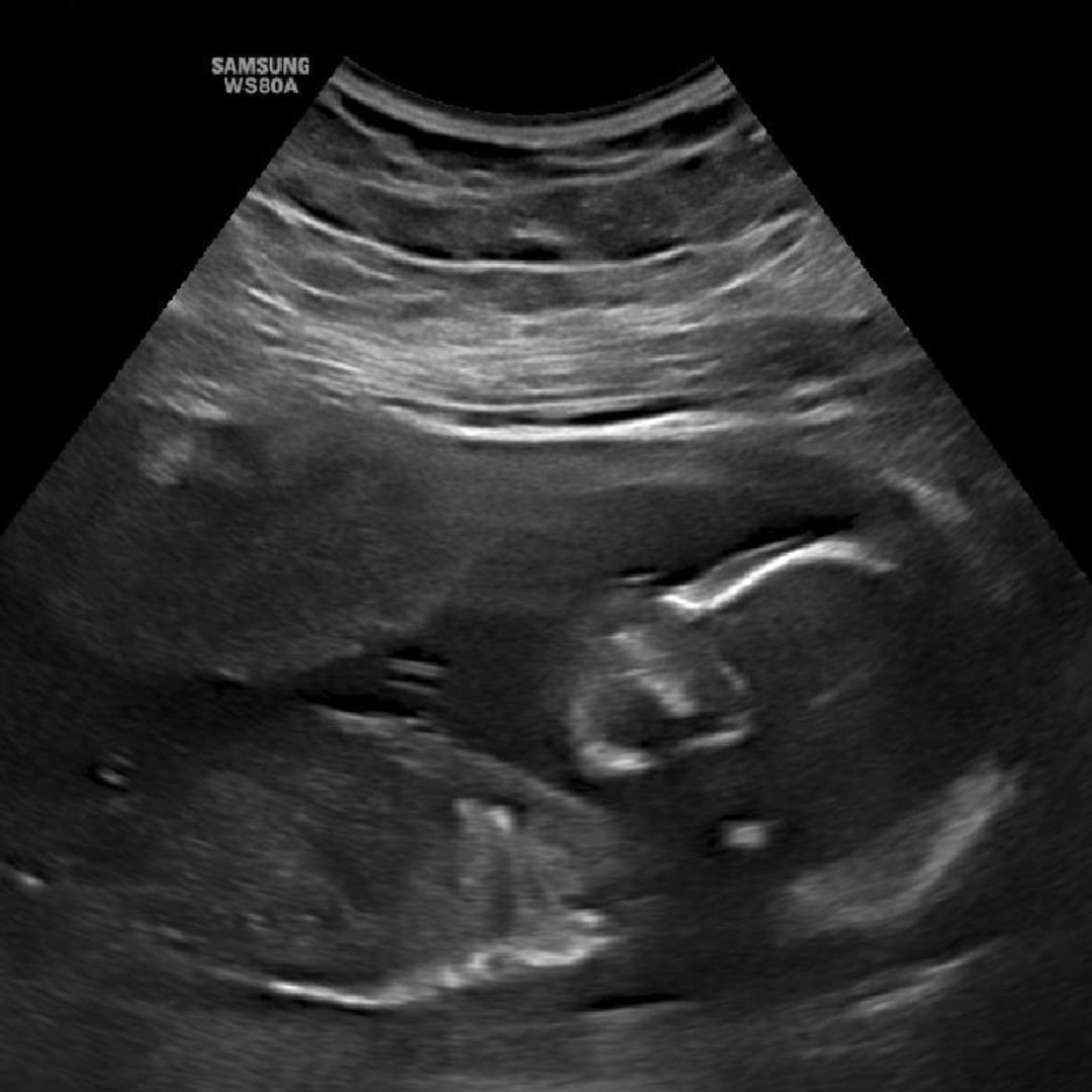 Photo shared by Gabrielle for their Babylist baby registry.