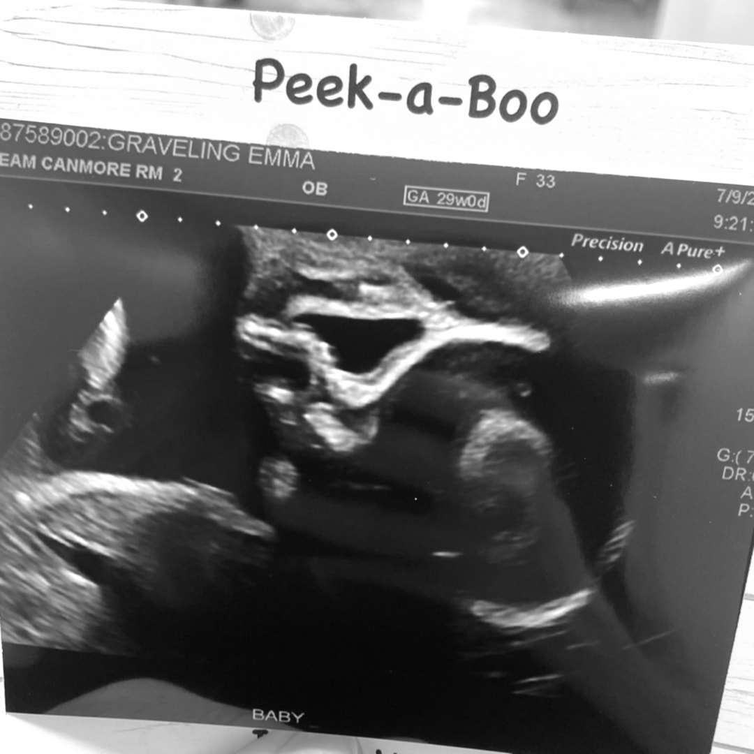 Photo shared by Emma for their Babylist baby registry.