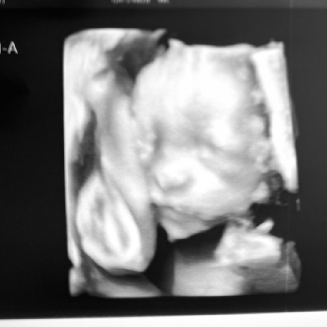 Photo shared by Mari for their Babylist baby registry.