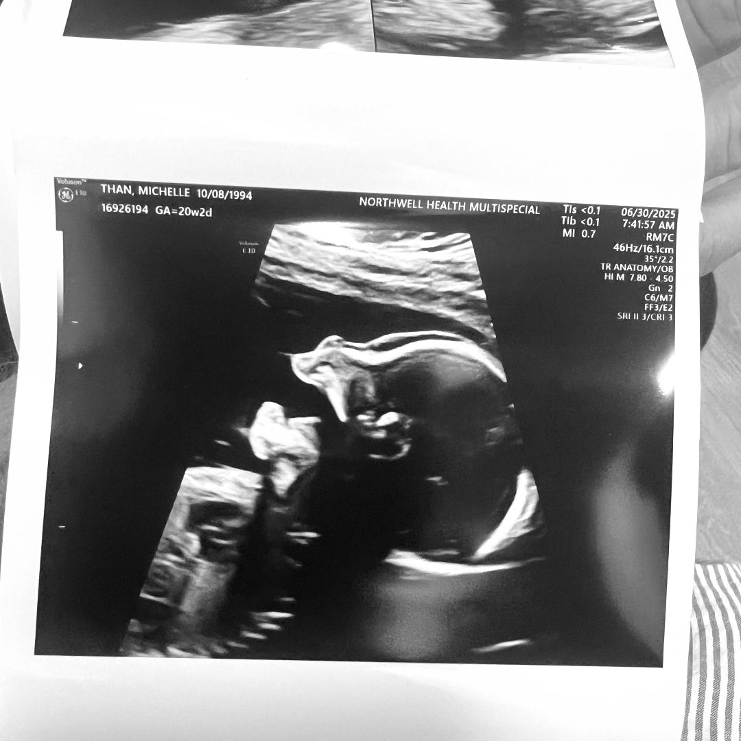 Photo shared by Michelle for their Babylist baby registry.