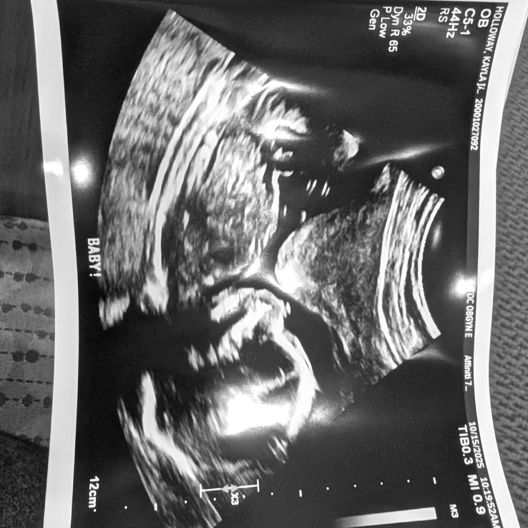 Photo shared by Kayla for their Babylist baby registry.