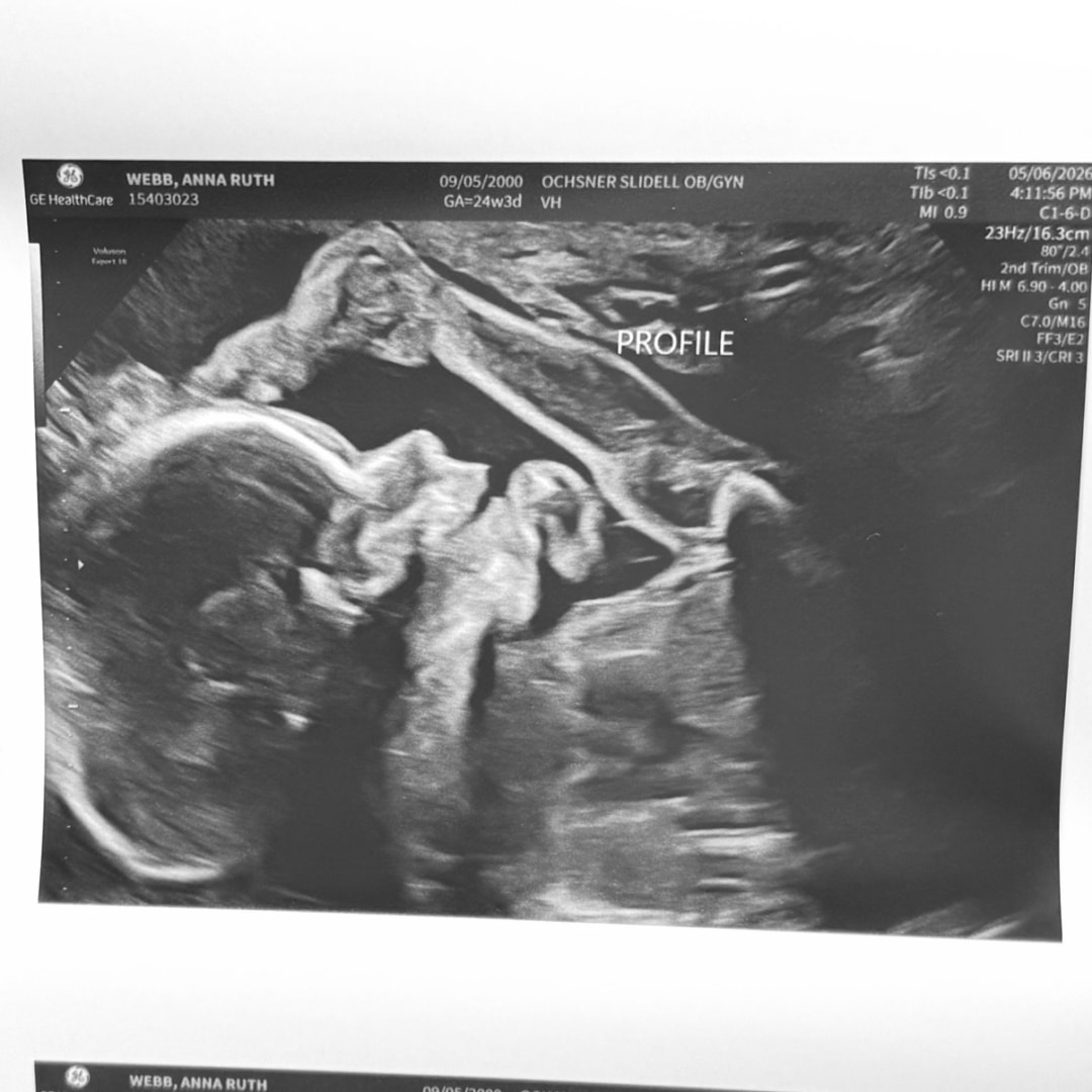 Photo shared by Anna for their Babylist baby registry.