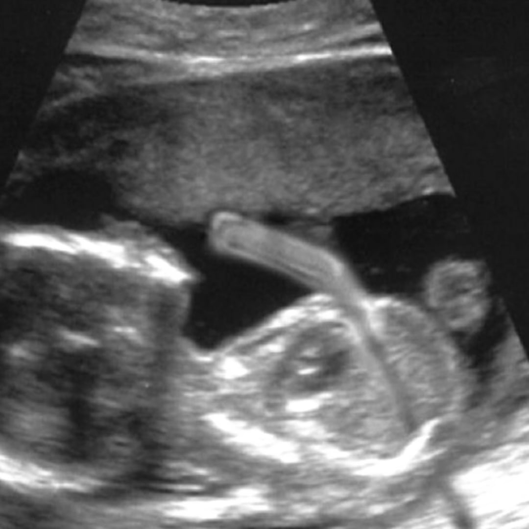 Photo shared by Caitlin for their Babylist baby registry.